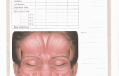 Botox Face Diagram Pdf Fill Online Printable Fillable Blank PdfFiller